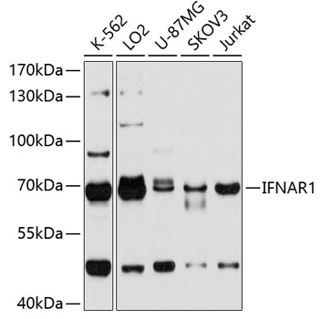 Anti-IFNAR1 Antibody
