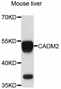 Anti-CADM2 Antibody