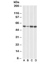 Western blot testing of human [A], fetal mouse [B], adult mouse [C] and adult rat [D] heart lysates with ATP5A1 antibody at 0.01ug/ml. Predicted molecular weight: ~55kDa.