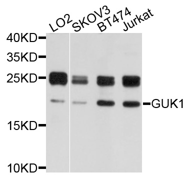 Anti-GUK1 Antibody