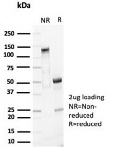 SDS-PAGE analysis of purified, BSA-free recombinant EpCAM antibody (EGP40/7035R) as confirmation of integrity and purity.