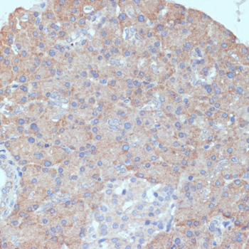 Anti-DGAT1 Antibody