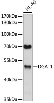 Anti-DGAT1 Antibody
