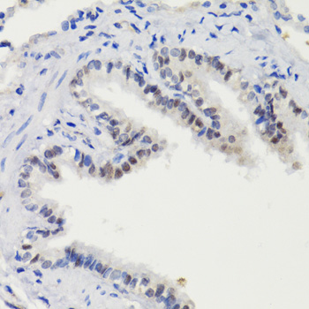 Anti-Stat3 (phospho S727) Antibody