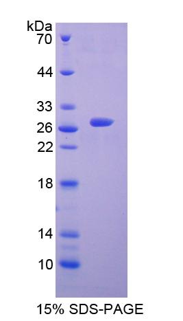 Figure. SDS-PAGE