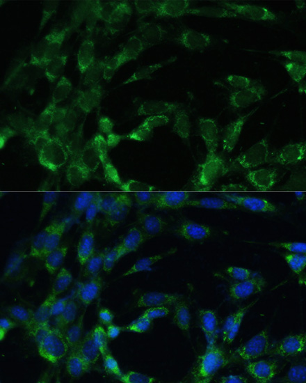 Anti-BCAT2 Antibody