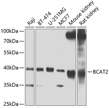 Anti-BCAT2 Antibody