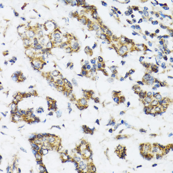Anti-DHRS2 Antibody