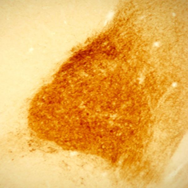 Neurotensin Antibody