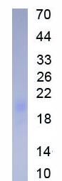 Figure. SDS-PAGE