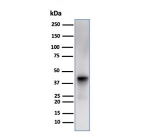 Western blot testing of human liver tissue lysate using Glutamine Synthetase antibody (clone GLUL/6600). Predicted molecular weight ~42 kDa.