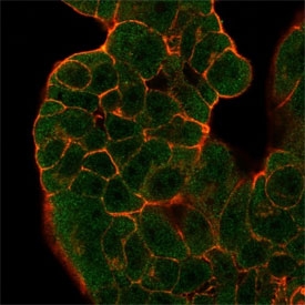 Immunofluorescent staining of PFA-fixed human MCF-7 cells BTF2 p44 antibody (green, clone PCRP-GTF2H2-1B9) and phalloidin (red).