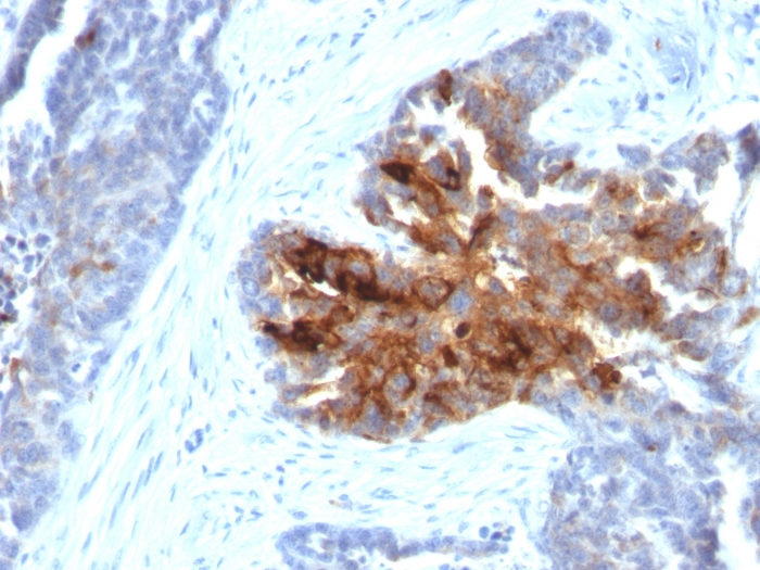 Anti-TAG72 Antibody [B72.3 + CA72/733] - BSA and Azide free