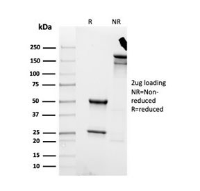 SDS-PAGE analysis of purified, BSA-free recombinant Cytokeratin 8 antibody (clone rKRT8/4209) as confirmation of integrity and purity.