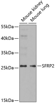 Anti-SFRP2 Antibody