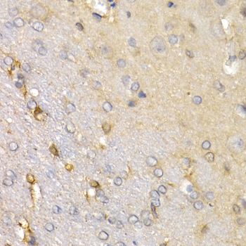 Anti-SFRP2 Antibody