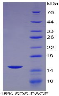 Figure. SDS-PAGE