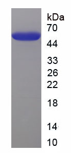 Figure. SDS-PAGE