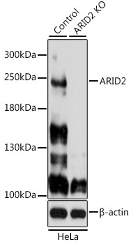 Anti-ARID2 Antibody
