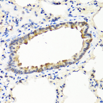 Anti-IFNW1 Antibody