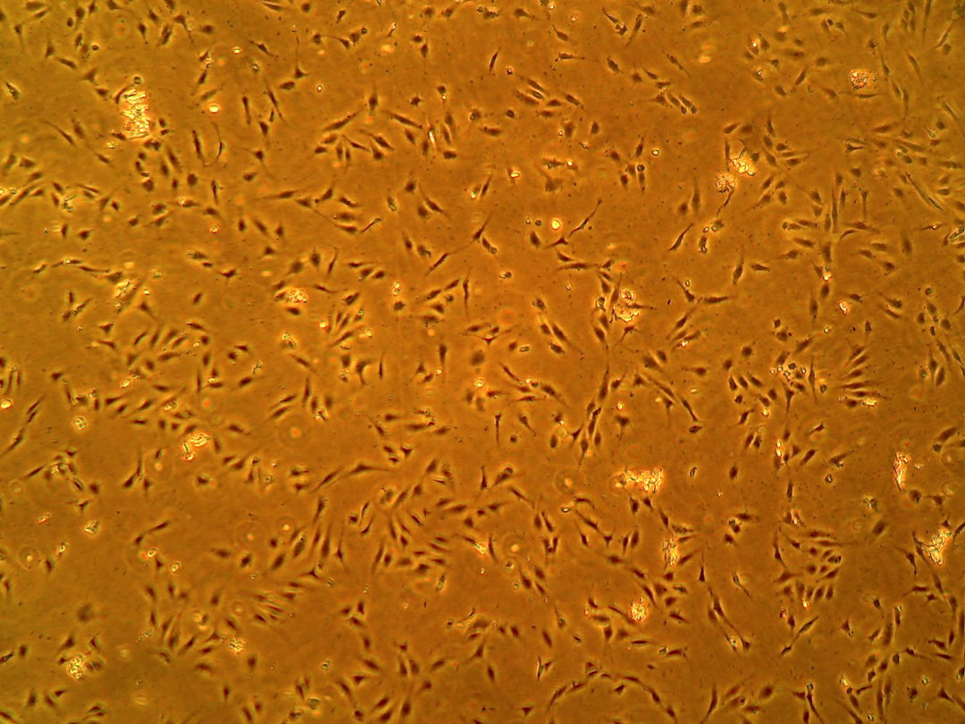 Primary Human Brain Microvascular Endothelial Cells