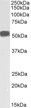 Anti-Desmin Antibody