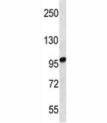STIM2 antibody western blot analysis in uterus tumor lysate. Predicted molecular weight: 84/94/68 kDa (isoforms 1/2/3).