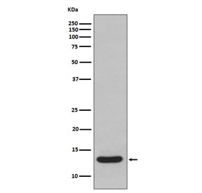 Western blot testing of human fetal liver lyste with FABP1 antibody. Predicted molecular weight ~14 kDa.