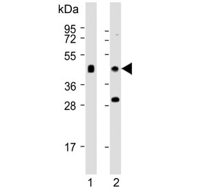 Western blot testing of human 1) skeletal muscle and 2) CCRF-CEM cell lysate with MCT10 antibody. Predicted molecular weight ~55 kDa.