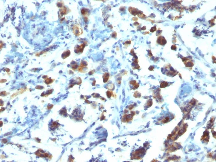Anti-MUC3 Antibody [SPM200]