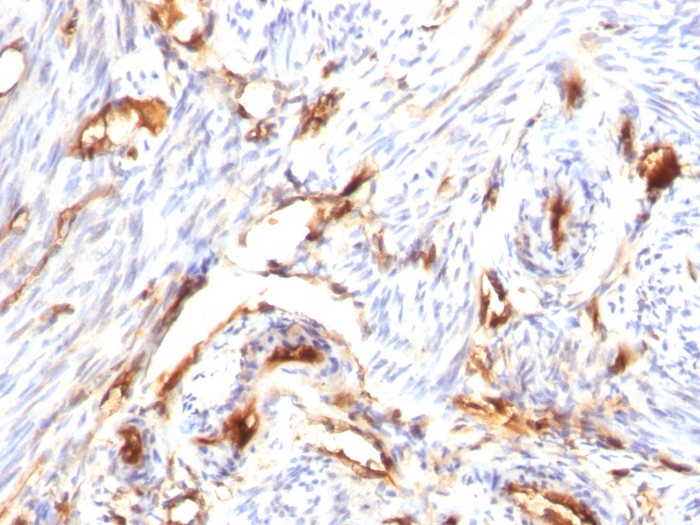 Anti-beta 2 Microglobulin Antibody [B2M/1118] - BSA and Azide free