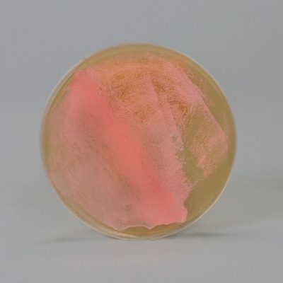 Halobacterium sp. NRC-1, Living, Plate