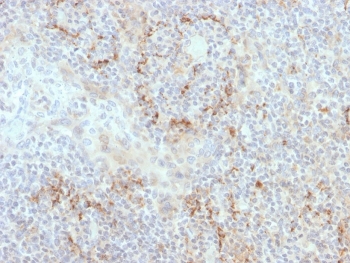 IHC staining of FFPE human tonsil with TIM-3 antibody. HIER: boil tissue sections in pH 9 10mM Tris with 1mM EDTA for 20 min and allow to cool before testing.