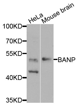 Anti-BANP Antibody