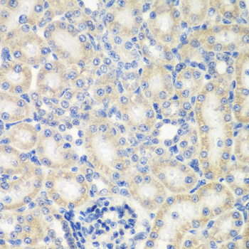 Anti-NAA50 Antibody
