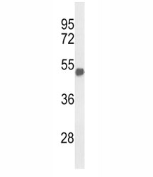 Western blot analysis of FOXG1 antibody and mouse brain tissue lysate. Predicted molecular weight ~ 52 kDa.