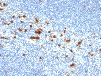 IHC testing of FFPE human tonsil with CD103 antibody (clone ITGAE/2474). HIER: boil tissue sections in pH9, 1mM EDTA buffer, for 10-20 min followed by cooling at RT for 20 min.
