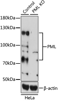 Anti-PML Antibody
