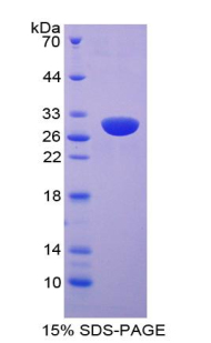 Figure. SDS-PAGE