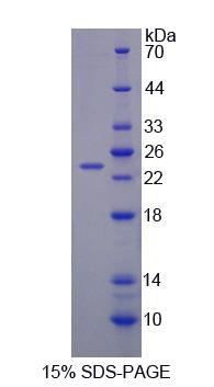 Figure. SDS-PAGE