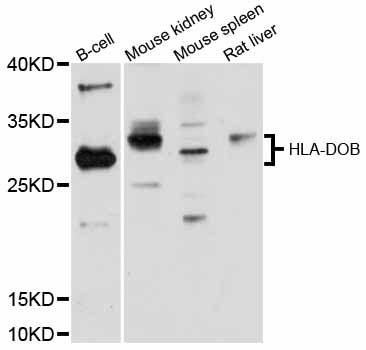 Anti-HLA-DOB Antibody