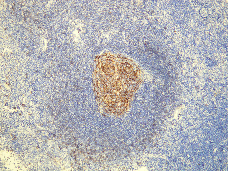 Anti-CD23 Antibody [E28-S]