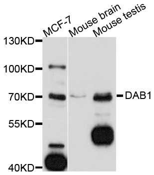Anti-DAB1 Antibody
