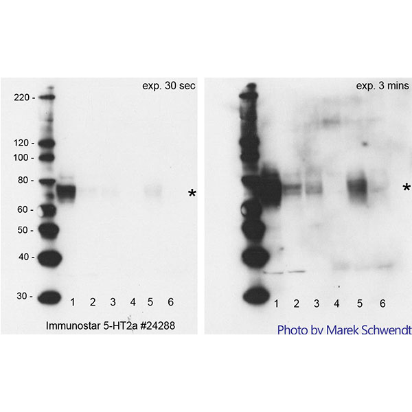 5-HT (Serotonin) 2A Receptor Antibody