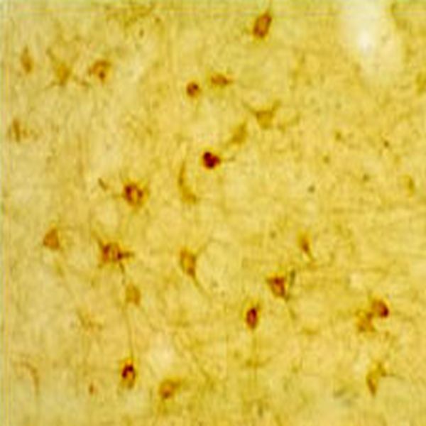 5-HT (Serotonin) 2A Receptor Antibody