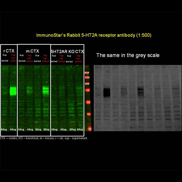 5-HT (Serotonin) 2A Receptor Antibody
