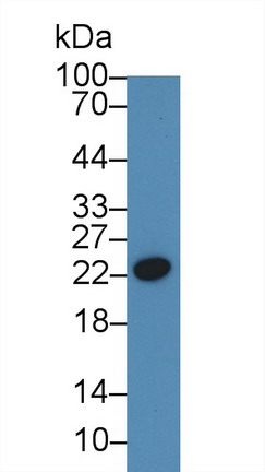 Western Blot; Sample: Bovine Serum; &lt;br/&gt;Primary Ab: 3µg/ml Rabbit Anti-Bovine CRP Antibody&lt;br/&gt;Second Ab: 0.2µg/mL HRP-Linked Caprine Anti-Rabbit IgG Polyclonal Antibody&lt;br/&gt;(Catalog: SAA544Rb19) Selected