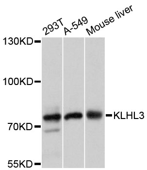 Anti-KLHL3 Antibody