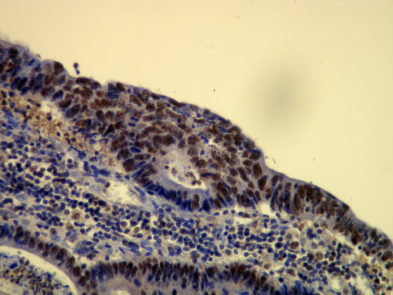 Anti-p60 Antibody [E17-L]