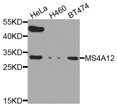 Anti-MS4A12 Antibody